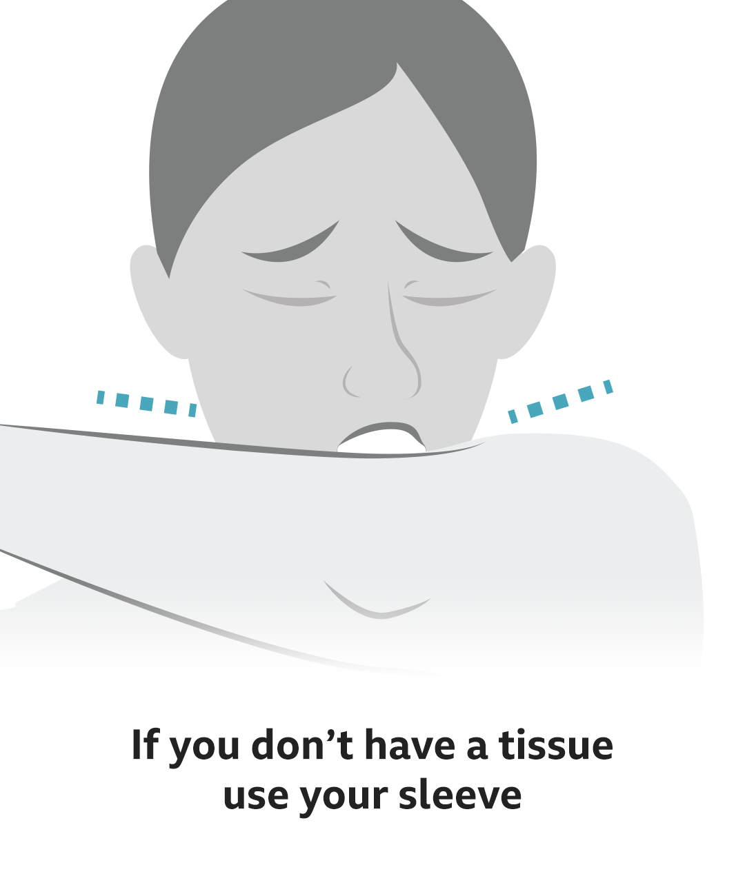 Use sleeve if no tissue